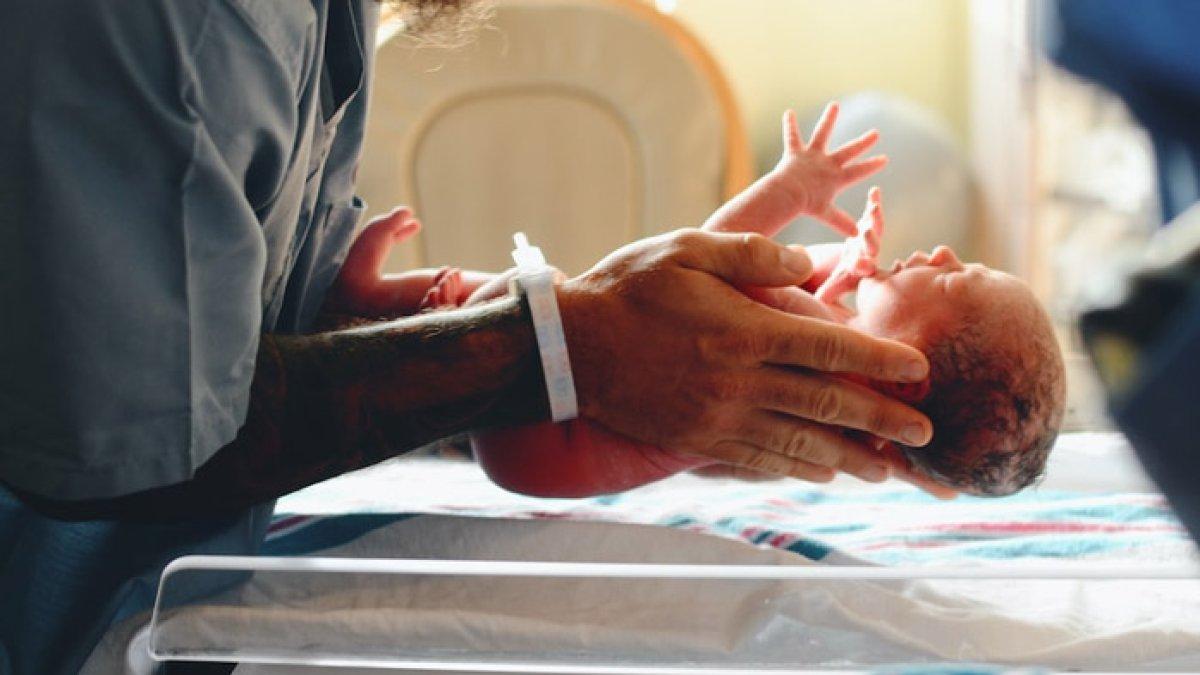 Bayi berkaki 6 itu akan dilakukan operasi pemisahan, ditangani 8 dokter spesialis