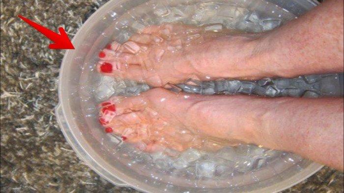 Ilustrasi merendam kaki dengan air es