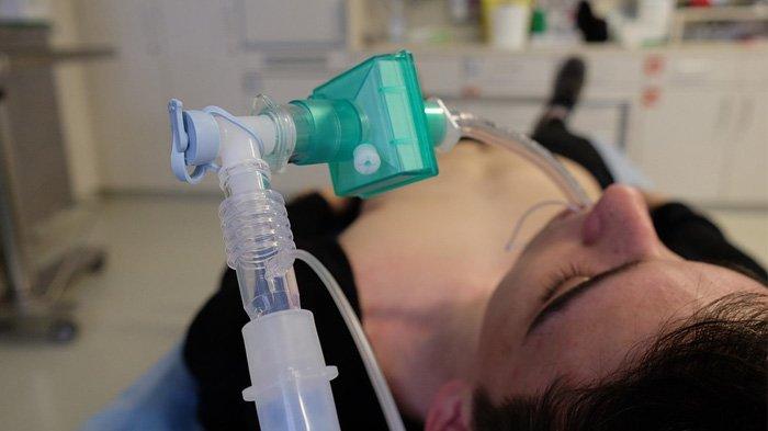 Ilustrasi pasien dengan ventilator.