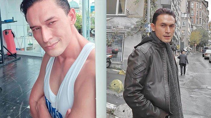 Indra bruggman masih jalani pengobatan rutin.