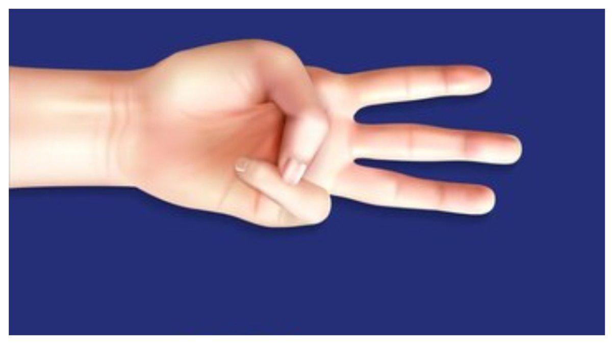JARI PUCAT - Jika jari-jari Anda berubah pucat atau kebiruan dalam suhu dingin, Anda mungkin memiliki penyakit Raynaud, suatu kondisi yang membatasi aliran darah ke ekstremitas.