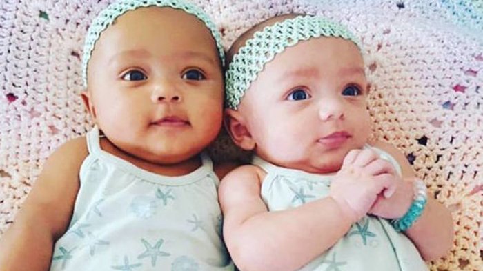 Ilustrasi bayi tertukar.