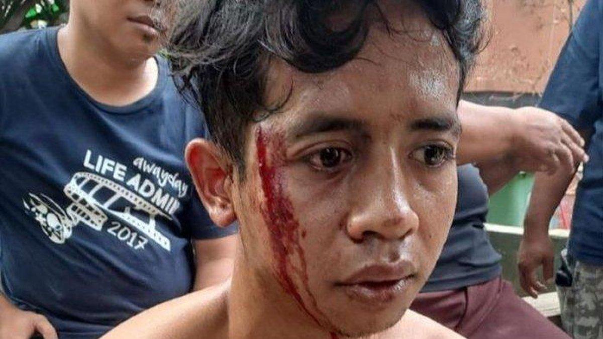 Kondisi Ridho yang dihajar warga karena dituduh komplotan pencuri.