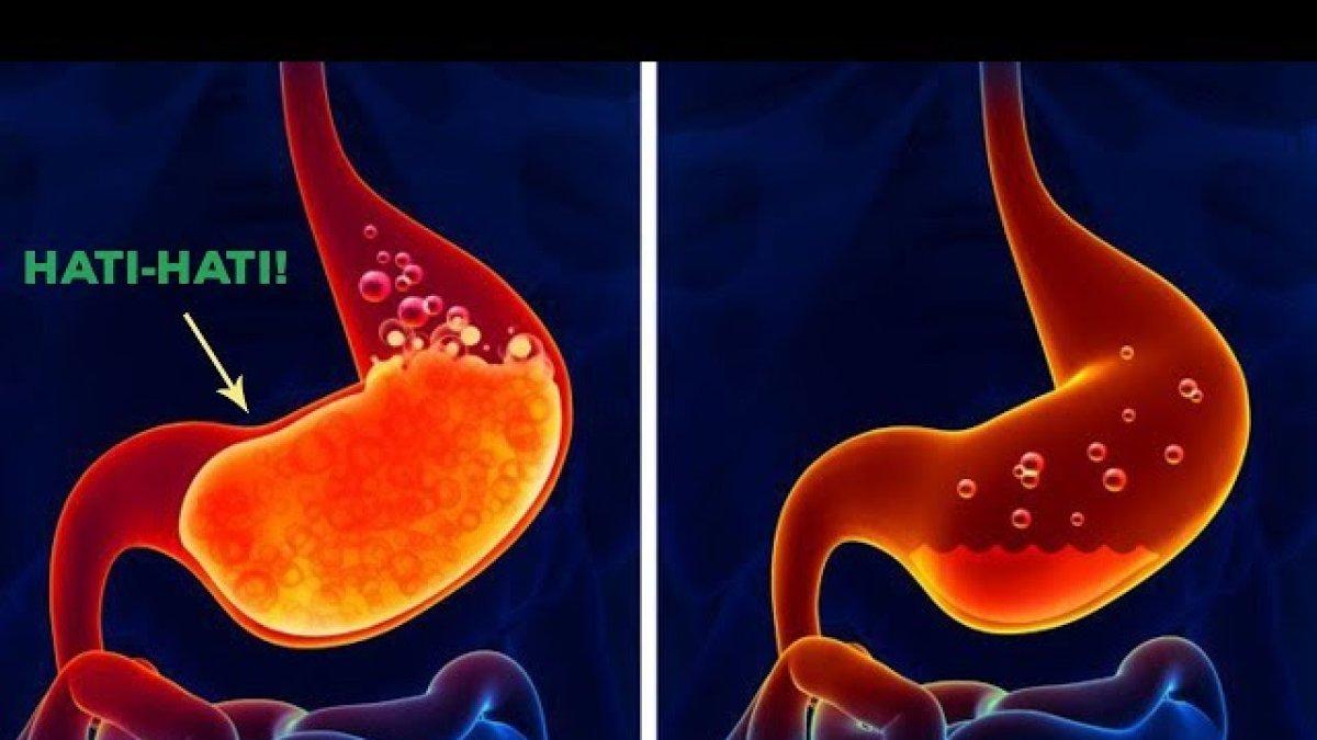 alkohol banyak mengandung gula, hindari alkohol ketika ingin diet