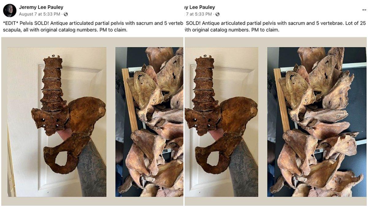 Pauley yang membeli tulang pelvis dan tulang belakang di Facebook dari Nott.
