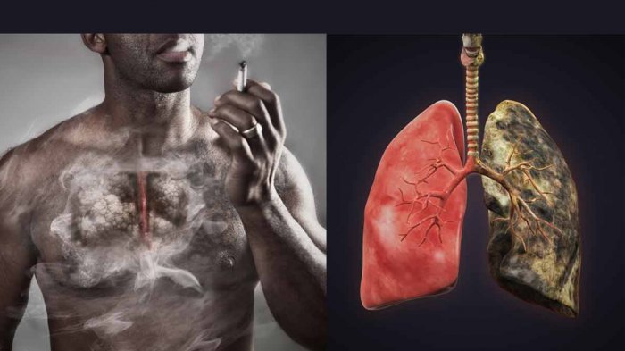 Cara Efektif Membersihkan Paru-Paru Setelah Berhenti Merokok