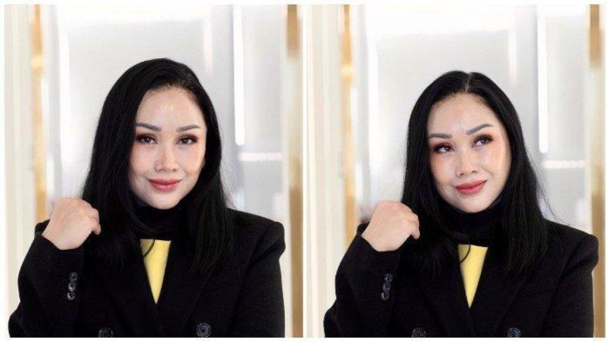 Potret Titi DJ setelah operasi plastik di Korea Selatan