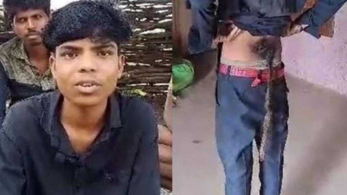 Seorang remaja memilik ekor di punggungnya