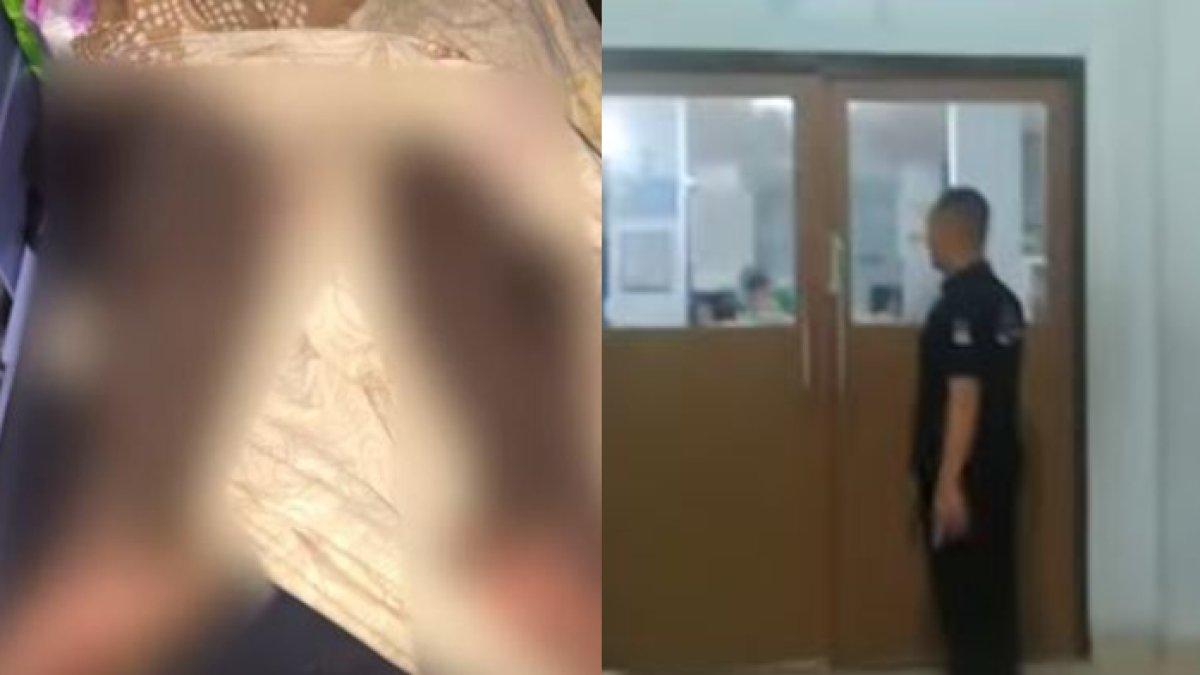 Terkuak penyebab kulit pria bersisik, ternyata usai minum collagen pemutih