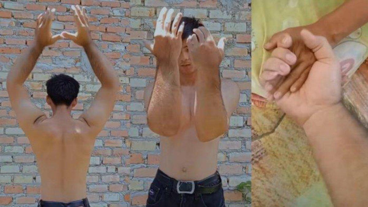 Van Daeng Saputra memiliki tangan besar dan panjang mirip tokoh kartun Popeye.