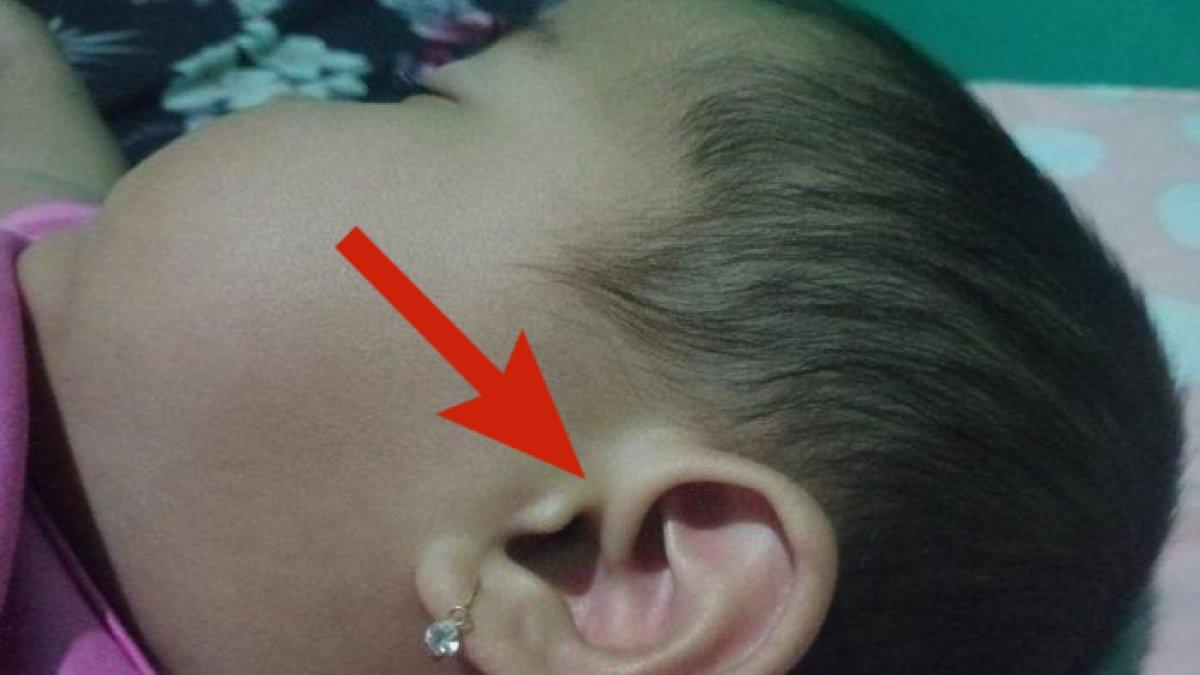 Viral bayi miliki telinga mirip lafadz Allah