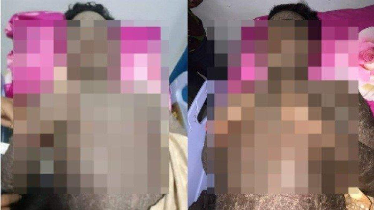 Viral tubuh seroang pria di Sultra bersisik