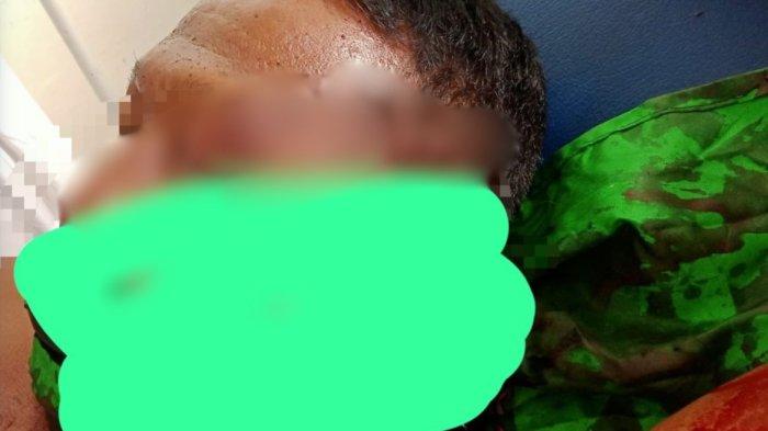Korban mendapat perawatan di Puskesmas usai diparangi pelaku. Kejadian di Desa Taan Mamuju