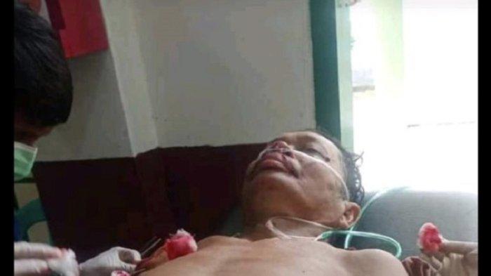 Korban penganiayaan gegara sengketa lahan sawit saat dirawat di RSUD Mamuju Tengah, Minggu (6/8/2023).