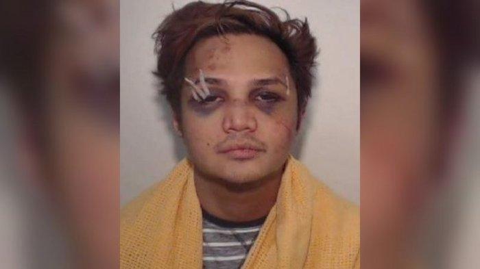 Kepolisian Manchester Raya merilis foto Reynhard Sinaga saat dia ditangkap dalam kondisi babak belur pada 2017 lalu.