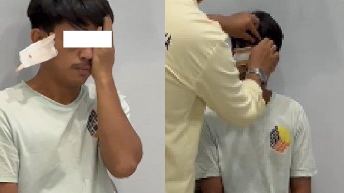 Salah satu korban pengeroyokan yang diduga dilakukan oknum polisi saat sedang nongkrong di Lorong Lamokato Jalan Pemuda, Kecamatan Kolaka, Kabupaten Kolaka, Sulawesi Tenggara Jumat (19/4/2024) sedang menjalani pemeriksaan visum.