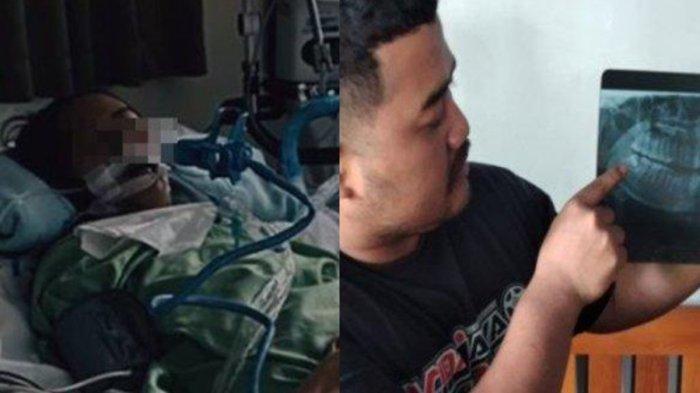5 Fakta Nira Istri di Ngawi Meninggal Usai Cabut Gigi Bungsu Infeksi Mulut Hingga Kesulitan Bernafas