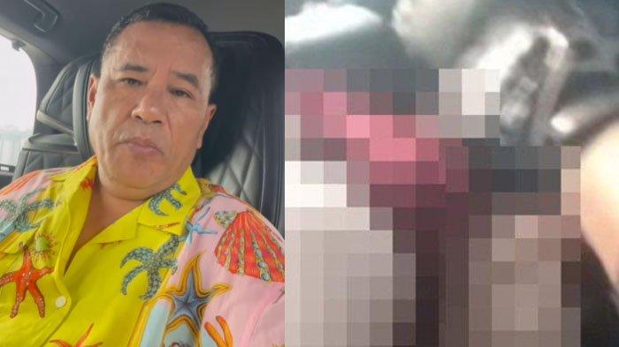 Hotman Paris Bereaksi Kasus Oknum Paspampres Aniaya Warga Aceh, Bantu Keluarga Korban