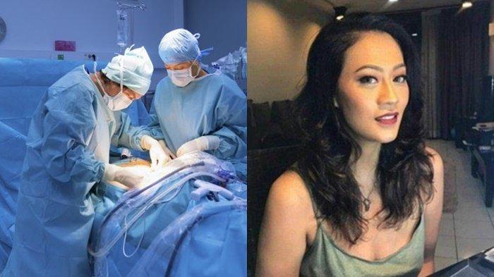 Ilustrasi dokter bedah operasi. Polisi mengungkap sosok dokter yang menangani proses operasi operasi sedot lemak Nanie Darham hingga berujung meninggal dunia. berinisial D, M, dan Y.