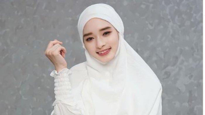 Inara Rusli alami kecelakaan saat menyetir sendiri