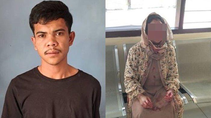 Anak aniaya ibu kandung hingga babak belur karena tak dibelikan motor RX King.