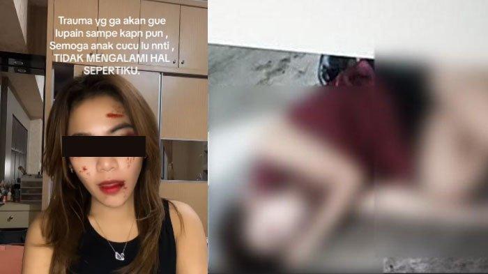 Keingian Terakhir Dini Tewas Dianiaya Diduga Anak Anggota DPR, Tak Mau Orang Alami Sama