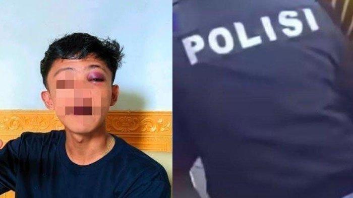 Kisah Remaja di Gorontalo Dipukuli Polisi Hingga Muntah Darah, Diberi Rp 50 Ribu Untuk Tutup Mulut
