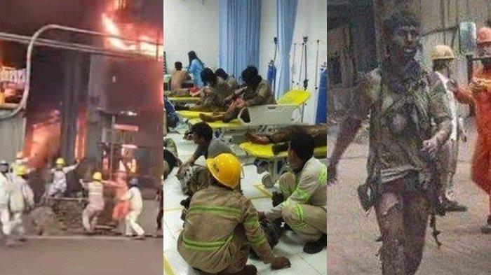 Kondisi terakhir Irfan Bukhori usai viral selamatkan diri dari tungku smelter PT Indonesia Tsingshan Stainless Steel (ITSS) di Kabupaten Morowali, Sulawesi Tengah, sempat berjalan dengan tubuh gosong.