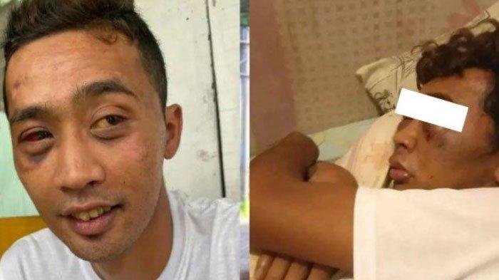 Mas Iwan, pengamen berketerbelakangan mental yang dipukul dan dikencingi orang