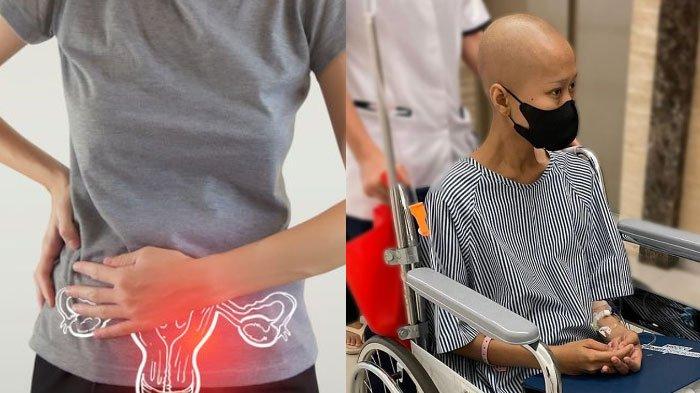 Mengenal Kanker Ovarium Penyebab Shella Selpi Lizah Meninggal Dunia