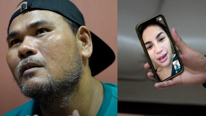 Nasib Pilu Fahmi BO Pemain Tukang Ojek Pengkolan, Tak Ada Uang Berobat, Dibayari Nikita Mirzani