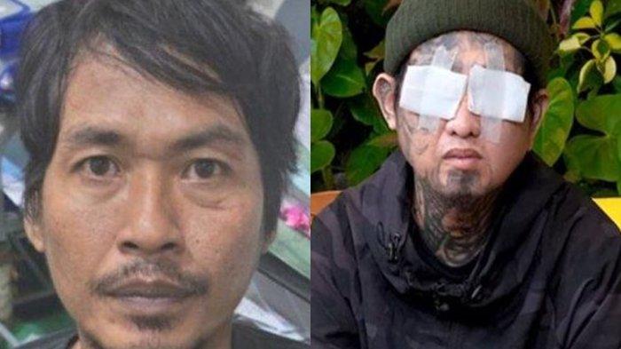 Pelaku yang congkel mata Faisal hingga alami kebutaan gegara cemburu ternyata menyerahkan diri.