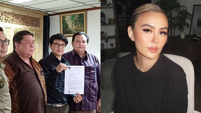 Penyanyi Agnez Mo mendadak disomasi oleh pencipta lagu Ari Bias terkait menyanyikan lagu ciptaannya “Bilang Saja” tanpa izin, kini dituntut Rp 1,5 M
