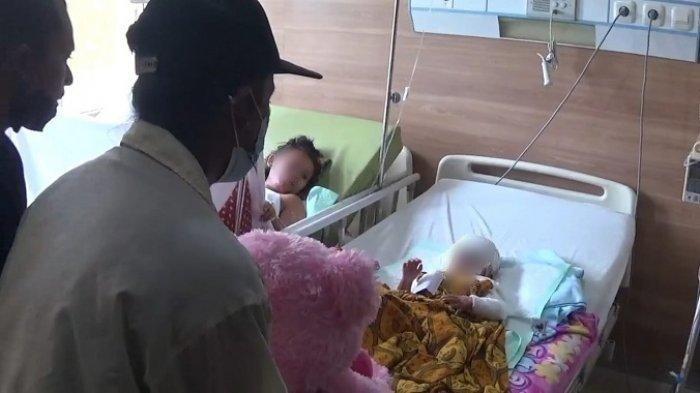 (kanan) balita berinisial R (4) menjadi korban disiram air keras oleh ayah kandungnya sendiri. Anaknya yang terus menangis dengan wajah penuh trauma