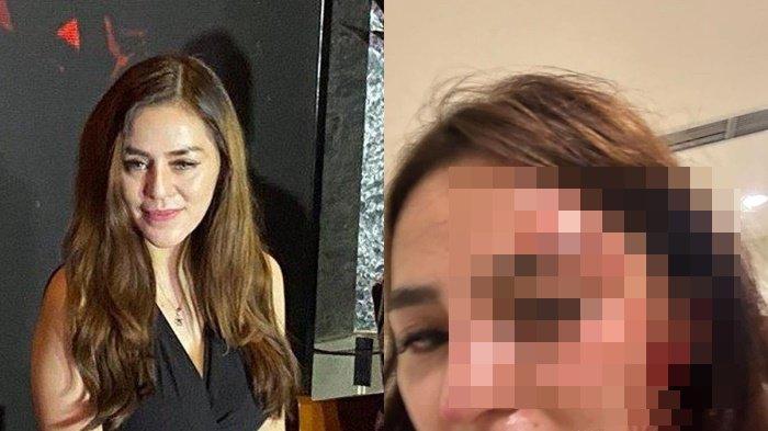 Seorang artis FTV bernama Safa Marwah melaporkan kekasihnya seorang ASN dugaan kasus penganiayaan. babak belur akibat dianiaya gegara tagih utang Rp 42 juta