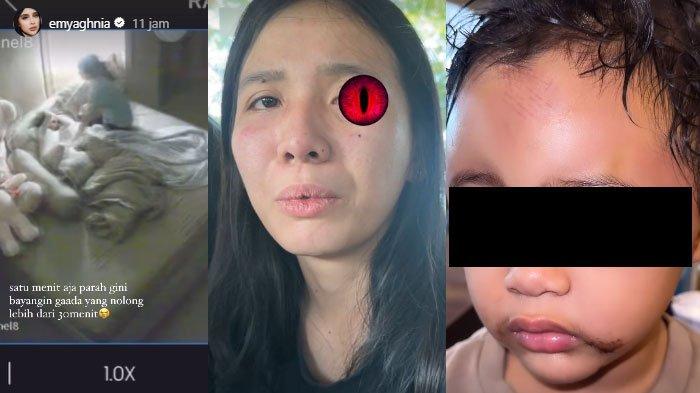 Siasat Pengasuh Aniaya Anak Aghnia Punjabi, Satu Jam Lakukan Penyiksaan Siram Minyak Panas ke Wajah