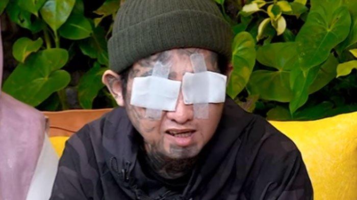 Terpuruknya Faisal Pria di Bogor Buta Mata Dicongkel, Sering Melamun Pikir Masa Depan
