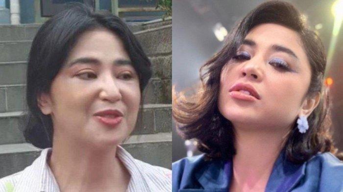 Wajah Dewi Perssik terbaru heboh jadi sorotan.