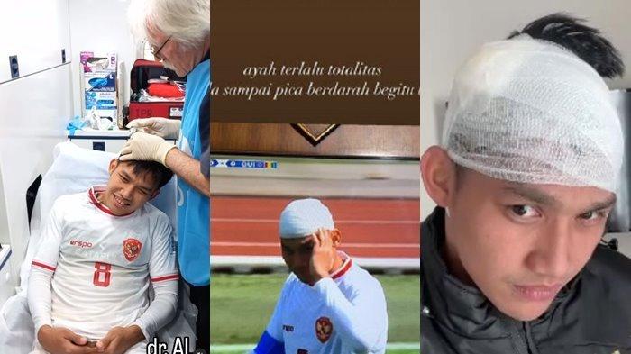 Witan Sulaeman mendapat 5 jahitan di kepalanya.