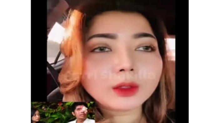 Youtuber Pratiwi Noviyanthi mengungkapkan kekesalannya terhadap keluarga Agus Salim, pria yang disiram air keras oleh rekan kerja.