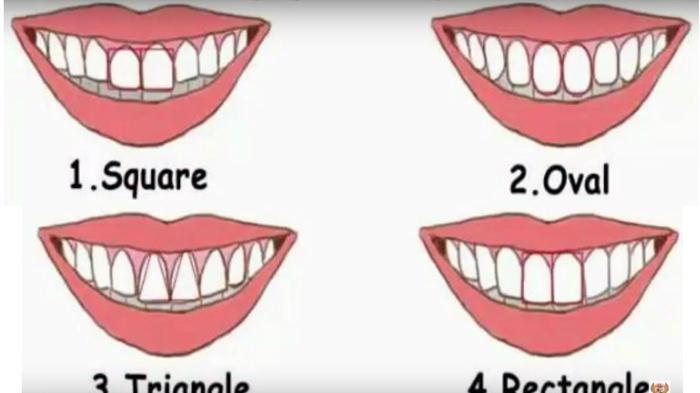 Melihat Kepribadian Seseorang dari Bentuk Giginya, Anda Yang Mana ...