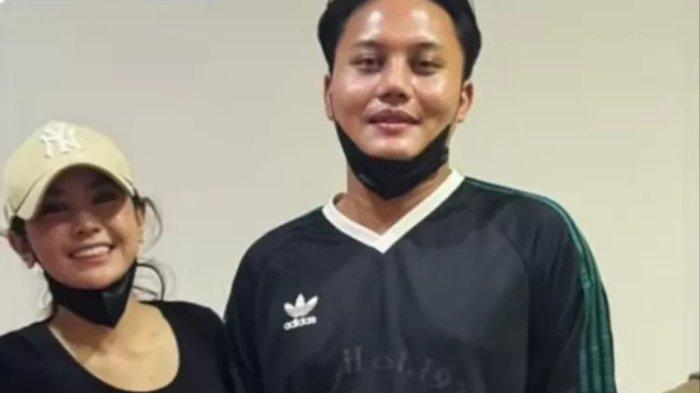 hidung Rizky Febian tampak sangat mancung sehingga ada yang menuding anak Sule ini ikut operasi plastik.