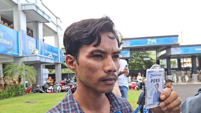 JURNALIS TRIBUN TERNATE KORBAN KEKERASAN - Jurnalis Tribun Ternate M. Julfikram Suhadi dipukul oknum Satpol PP saat meliput aksi mahasiswa di depan Kantor Wali Kota Ternate, Senin (24/2/2025). Berikut fakta-fakta jurnalis Tribun Ternate Julfikram Suhadi dipukul oknum Satpol PP Ternate.