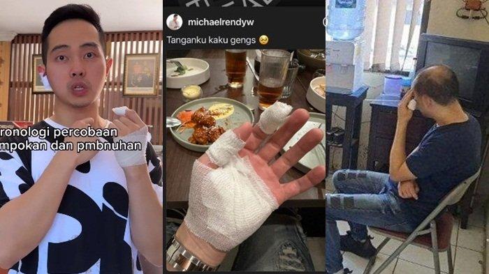 Leher Ditodong Pisau, Kondisi Michael Rendy Usai Lawan Rampok, Kini ...