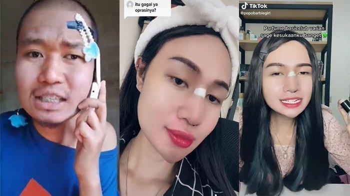 Popo Barbie benar-benar melakukan operasi dibagian hidung untuk mempercantik penampilannya bak barbie