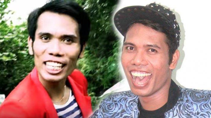 Udin Sedunia, penyanyi yang dulu sempat viral.