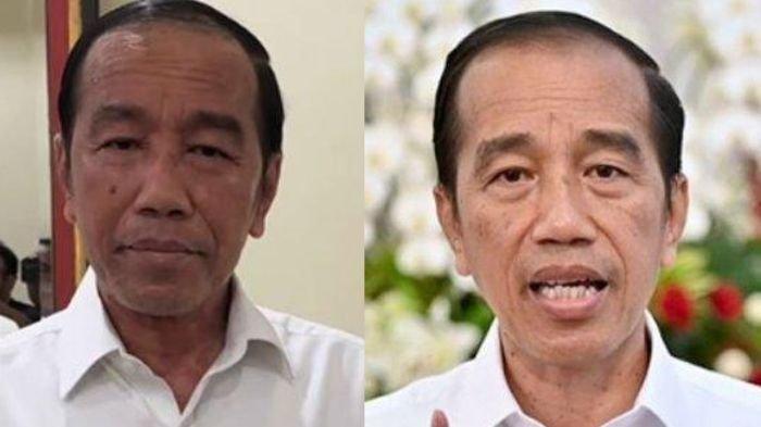 KONDISI WAJAH JOKOWI - Kabar Joko Widodo alias Jokowi sakit kulit menyita perhatian publik. Ada yang mengira hal itu karea autoimun, ada juga yang menganggapnya Stefen Johnson.