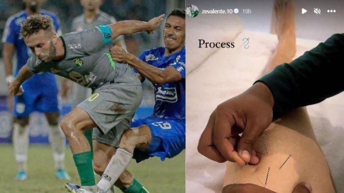 Kiri: Ze Valente saat membela Persebaya Surabaya. Kanan: Ze saat menjalani pemulihan cedera