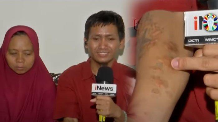 Pegi Setiawan menunjukkan tatoo bergambar bintang di lengan kanannya.