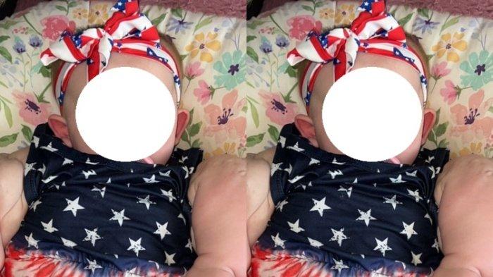 Seorang bayi mengidap penyakit langka hingga memiliki tangan kekar dan dijuluki baby Hulk